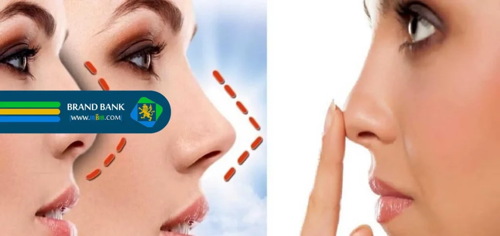 جراحی بینی سعادت آباد