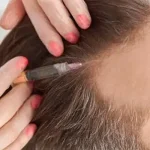 اگر از ریزش مو کلافه شده‌اید، این روش‌ها را امتحان کنید