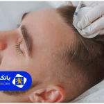 لیست 10تا از بهترین مرکز فیشیال پوست در تهران + تلفن و آدرس