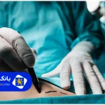 ۲۰سوال پرتکرار که قبل از مراجعه به بهترین دکتر پیکرتراشی در تهران باید بررسی کنید